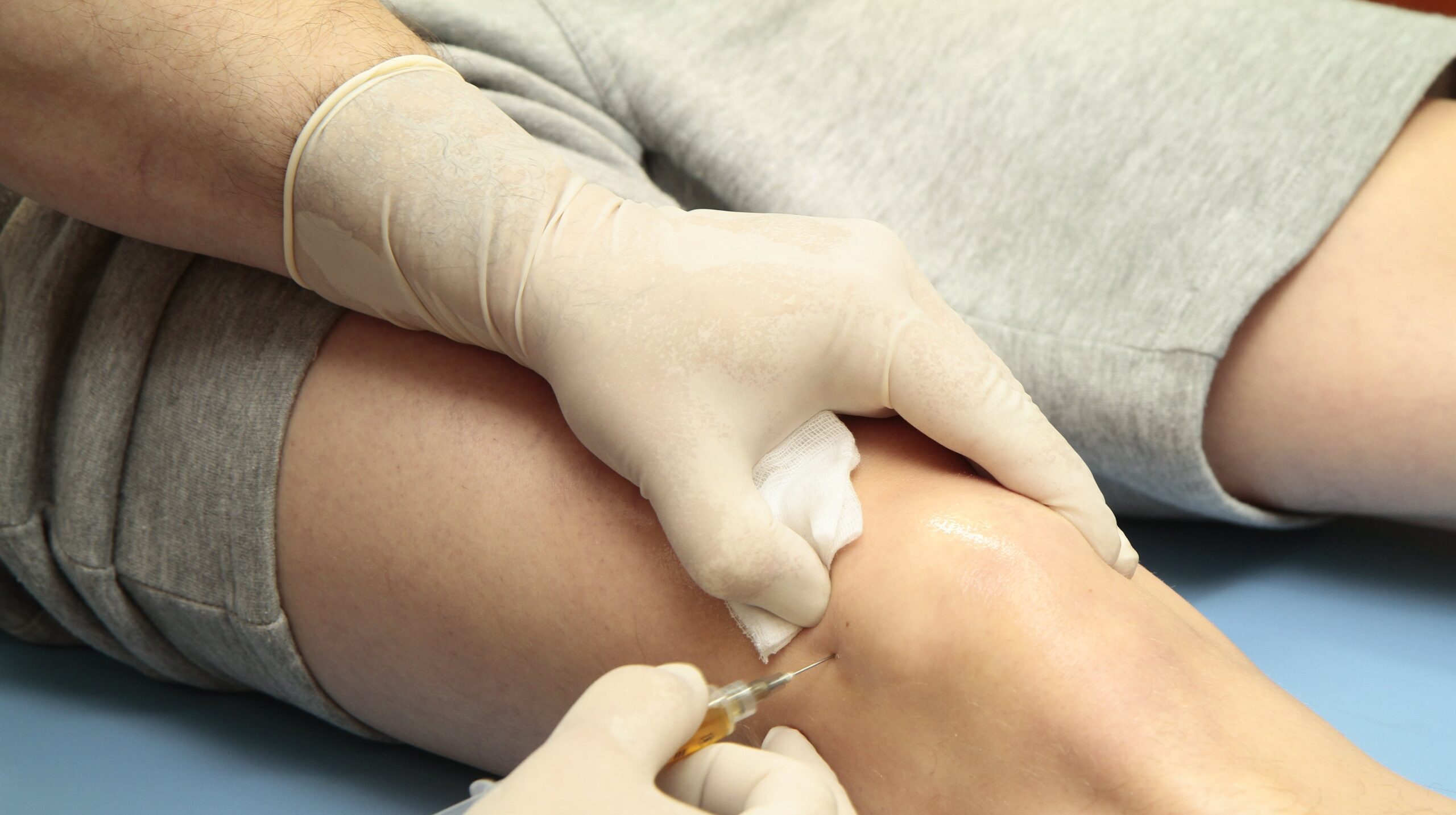 Veins Treatment Veins Treatment