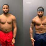 Weight Loss