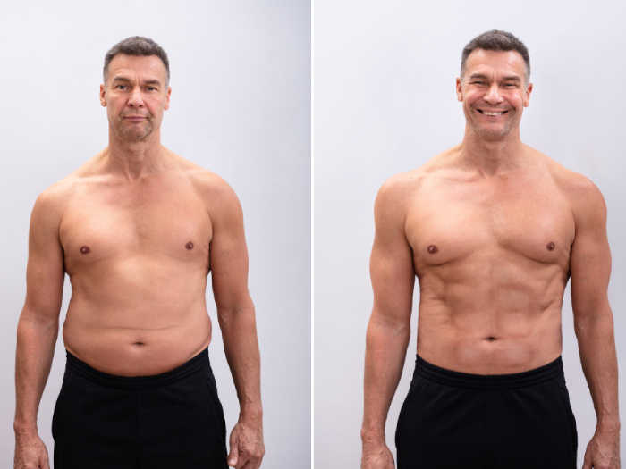 Weight Loss
