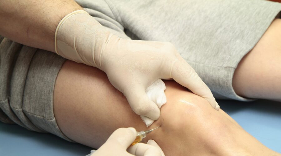 Veins Treatment Veins Treatment